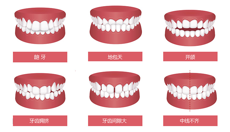 牙齿畸形有什么危害？