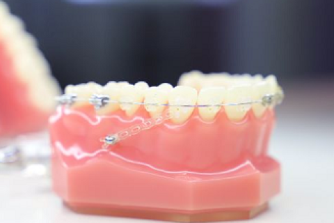 牙齿矫正受什么因素影响？