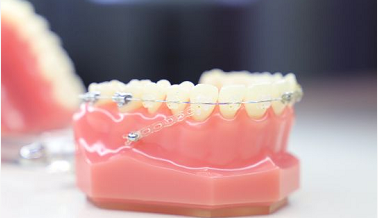 牙齿矫正受什么因素影响？