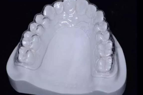 牙齿矫正后为什么还要戴保持器？不戴可以吗？