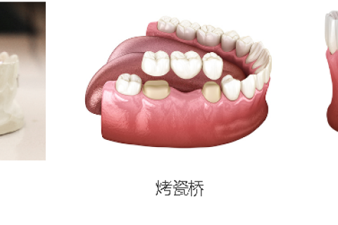 镶牙和补牙有什么区别？